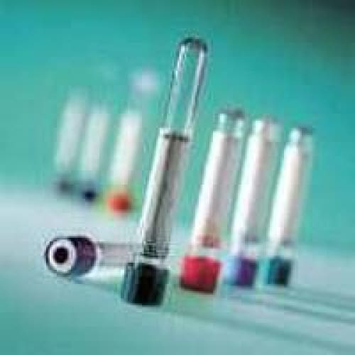 BD Medical Vacutainer Tube 5Ml 13 X 100Mm Gold Sst Case of 10 - Lab Supplies >> Blood Collection - BD Medical